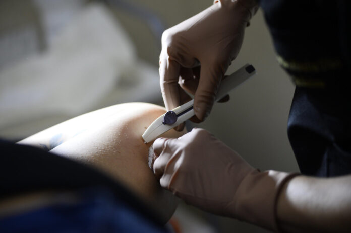 Profissional de saúde realiza inserção de implante contraceptivo Implanon em unidade básica de saúde do DF.