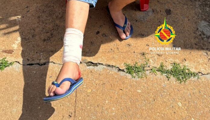 Imagem relacionada à ocorrência de ataque de pitbull no Paranoá DF