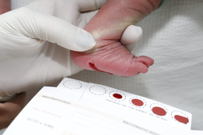 DF é o primeiro a implementar diagnóstico precoce da doença de Fabry por meio do teste do pezinho