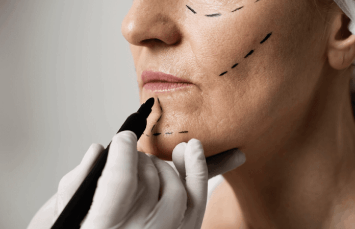 Profissional de saúde realiza avaliação para procedimento estético com preenchedores faciais