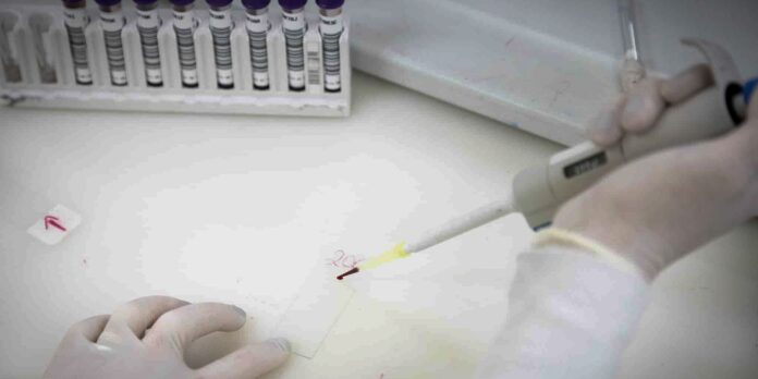 Paciente em São Paulo com suspeita de ebola apresenta resultado positivo para meningite