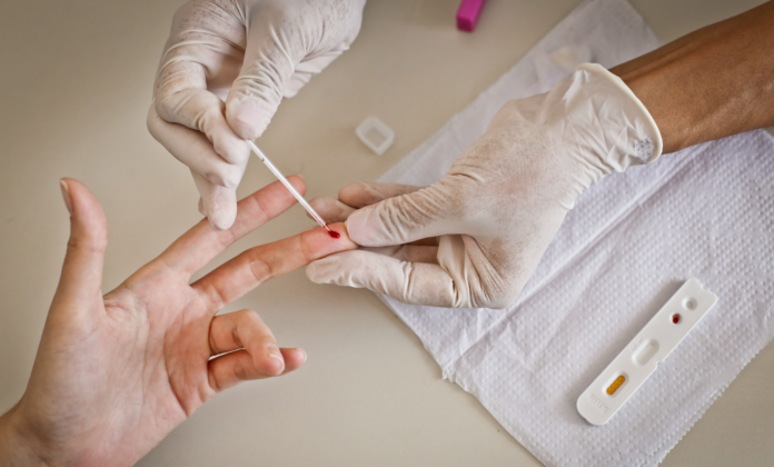 Preconceito em relação a pacientes com HIV continua a dificultar diagnóstico e tratamento