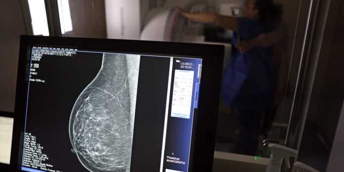 Entidades orientam médicos sobre solicitações de mamografia digital
