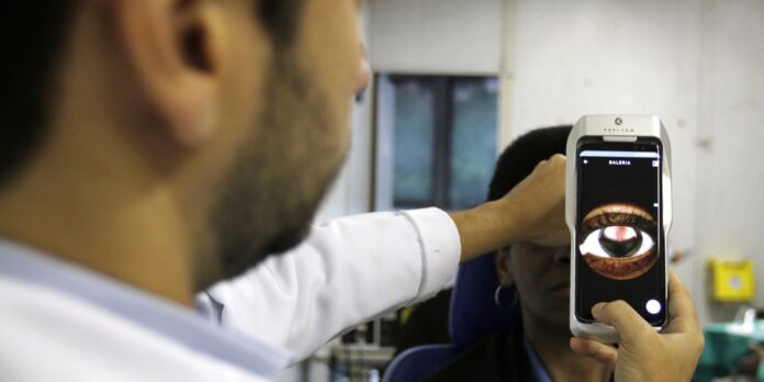 Retinopatia: condição ocular atinge um em cada três diabéticos